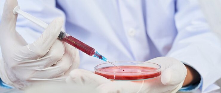 Blood Tests In Rohini